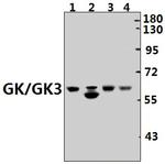 Glycerol kinase Antibody in Western Blot (WB)
