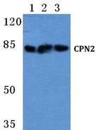 CPN2 Antibody in Western Blot (WB)