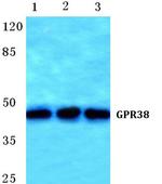 MLNR Antibody in Western Blot (WB)