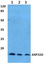 ANP32D Antibody in Western Blot (WB)