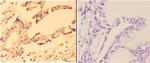 ABCC11 Antibody in Immunohistochemistry (Paraffin) (IHC (P))