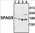 JLP Antibody in Western Blot (WB)