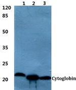 Cytoglobin Antibody in Western Blot (WB)