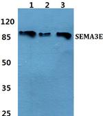 SEMA3E Antibody in Western Blot (WB)