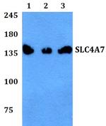 SLC4A7 Antibody in Western Blot (WB)