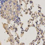 NEK8 Antibody in Immunohistochemistry (Paraffin) (IHC (P))