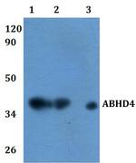 ABHD4 Antibody in Western Blot (WB)
