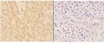 ADAMTS7 Antibody in Immunohistochemistry (Paraffin) (IHC (P))