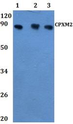 CPXM2 Antibody in Western Blot (WB)