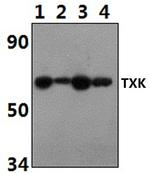 TXK Antibody in Western Blot (WB)