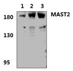 MAST2 Antibody in Western Blot (WB)