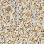 GRK3 Antibody in Immunohistochemistry (Paraffin) (IHC (P))