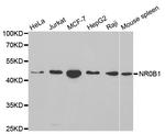 NR0B1 Antibody in Western Blot (WB)