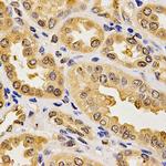 PON2 Antibody in Immunohistochemistry (Paraffin) (IHC (P))