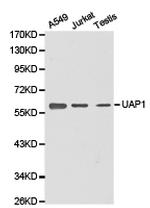 UAP1 Antibody in Western Blot (WB)