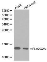 PLA2G2A Antibody in Western Blot (WB)