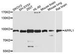 APPL1 Antibody in Western Blot (WB)