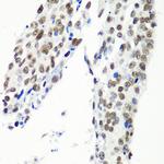 HTATSF1 Antibody in Immunohistochemistry (Paraffin) (IHC (P))