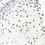 PRP8 Antibody in Immunohistochemistry (Paraffin) (IHC (P))