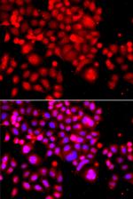 ASCC3 Antibody in Immunocytochemistry (ICC/IF)