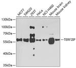 RAP1 Antibody in Western Blot (WB)