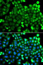 NCALD Antibody in Immunocytochemistry (ICC/IF)