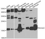 NCALD Antibody in Western Blot (WB)