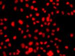 PRICKLE2 Antibody in Immunocytochemistry (ICC/IF)