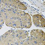 Thrombospondin 2 Antibody in Immunohistochemistry (Paraffin) (IHC (P))