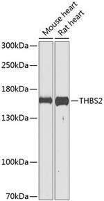 Thrombospondin 2 Antibody in Western Blot (WB)