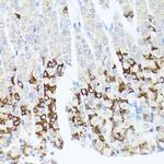 GPM6A Antibody in Immunohistochemistry (Paraffin) (IHC (P))