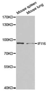 IFI16 Antibody in Western Blot (WB)