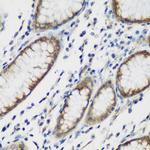 TTBK2 Antibody in Immunohistochemistry (Paraffin) (IHC (P))