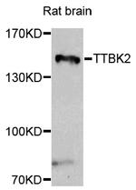 TTBK2 Antibody in Western Blot (WB)