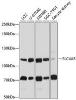 SLC4A5 Antibody in Western Blot (WB)