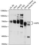 AGPS Antibody in Western Blot (WB)