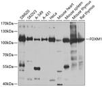 FOXM1 Antibody in Western Blot (WB)