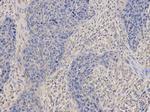 DNM1L Antibody in Immunohistochemistry (Paraffin) (IHC (P))