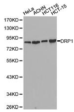 DNM1L Antibody in Western Blot (WB)