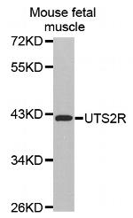 Urotensin II Receptor Antibody in Western Blot (WB)