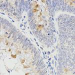 RAMP2 Antibody in Immunohistochemistry (Paraffin) (IHC (P))