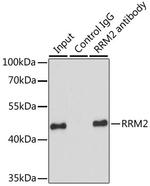RRM2 Antibody in Immunoprecipitation (IP)