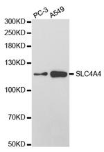 SLC4A4 Antibody in Western Blot (WB)