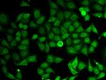 IMPDH2 Antibody in Immunocytochemistry (ICC/IF)