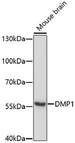 DMP1 Antibody in Western Blot (WB)