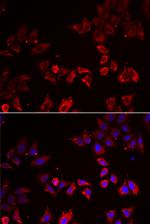 LIMS1 Antibody in Immunocytochemistry (ICC/IF)