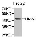 LIMS1 Antibody in Western Blot (WB)