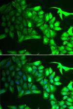 AIPL1 Antibody in Immunocytochemistry (ICC/IF)