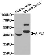 AIPL1 Antibody in Western Blot (WB)