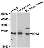 MYL3 Antibody in Western Blot (WB)